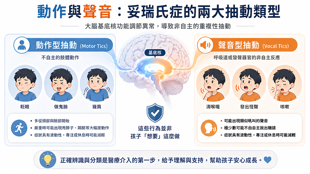 動作與聲音:妥瑞氏症的兩大抽動類型