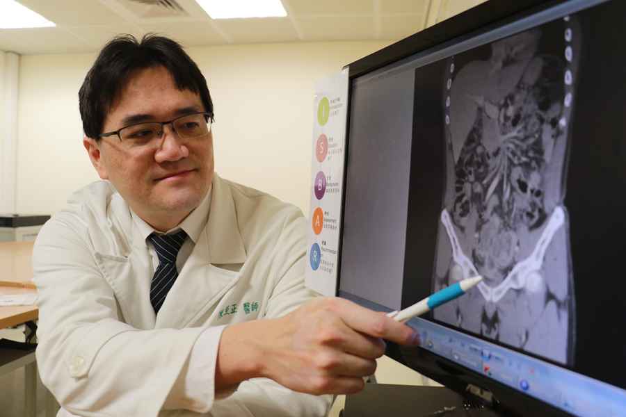 解尿出現排氣聲竟罹大腸癌