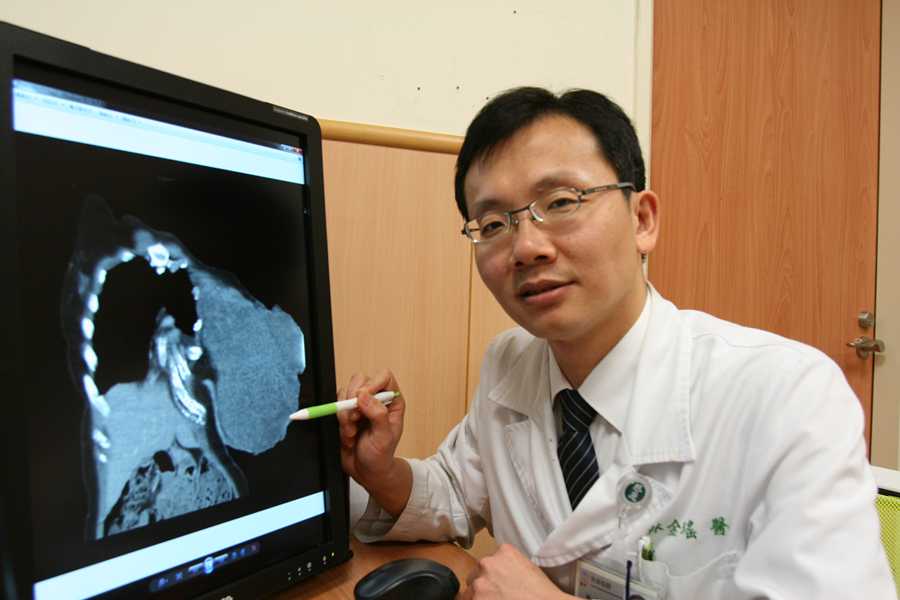 乳房葉狀瘤長到比人頭大 醫師籲病人積極治療免遺憾