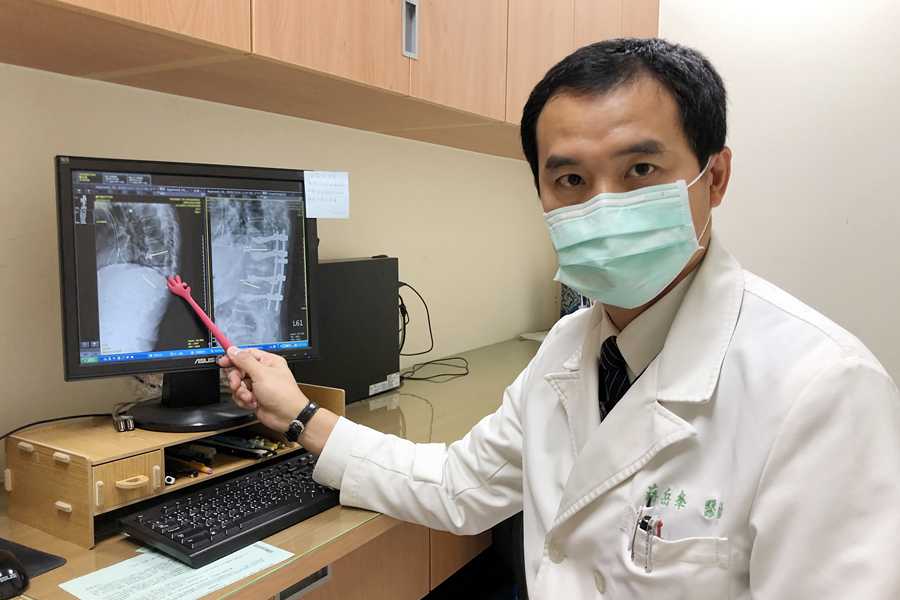 跌倒半年矮十公分 脊椎截骨矯正讓他再挺胸