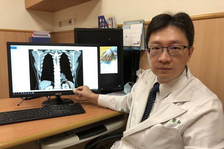 婦人胃血管闖進肺臟咳血十年 「極為罕見」游離肺