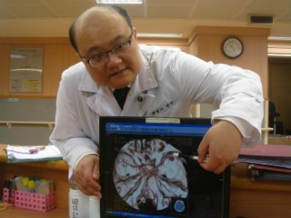 年輕女孩腦動脈瘤破裂中風 中西醫團隊合力搶救獲重生