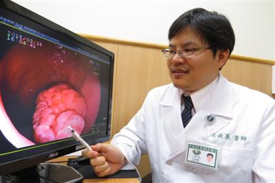 九旬婦腫瘤阻塞胃部微創手術 三天下床